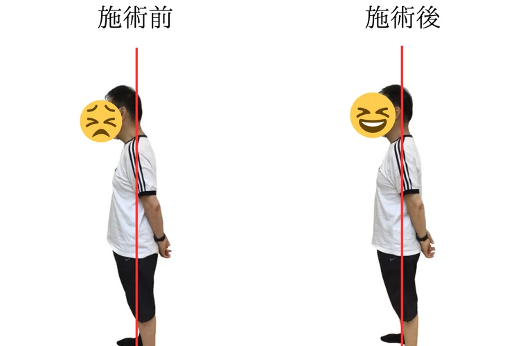 頭痛の緩和 | 尾張旭市の整体なら【姿勢や動作の研究所】ネオ整体EGAO