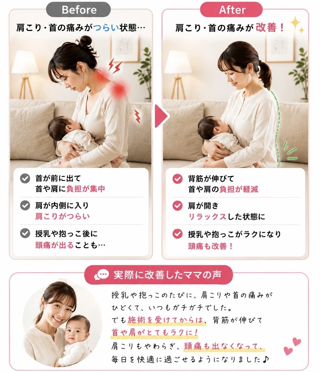 施術後の肩こり改善例